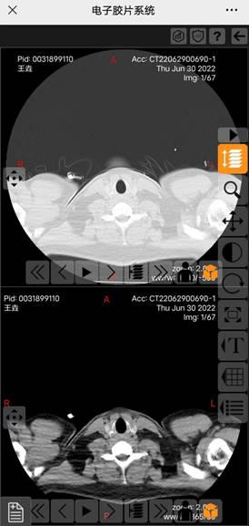 说明: WechatIMG276
