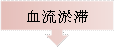 血流淤滞