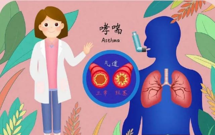 支气管哮喘(简称哮喘)是一种由遗传,环境,免疫,精神,感染,药物等多种